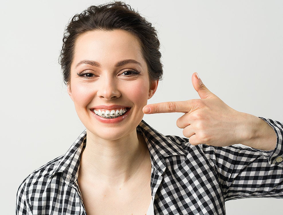 Adult Orthodontic Treatment Parkland And Coral Springs